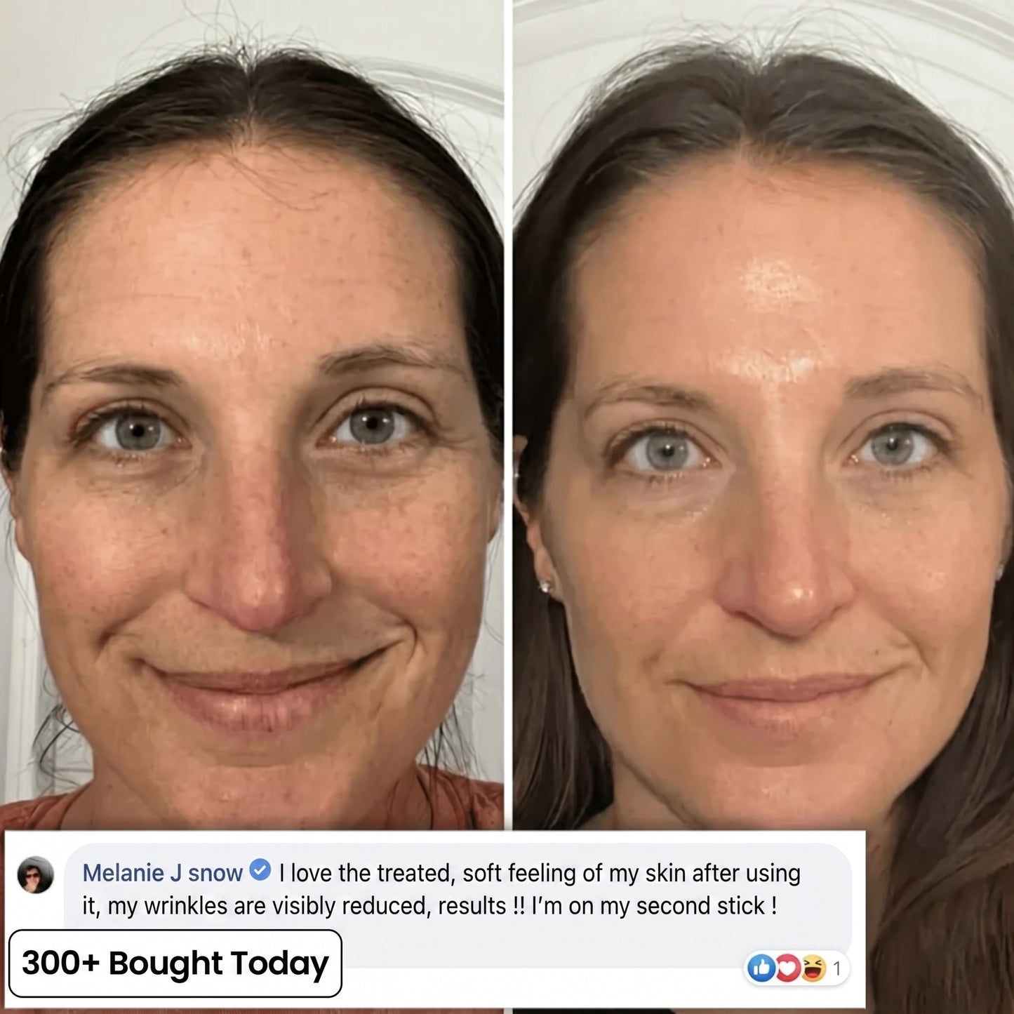 Bio-Collagen PDRN Plumping Stick