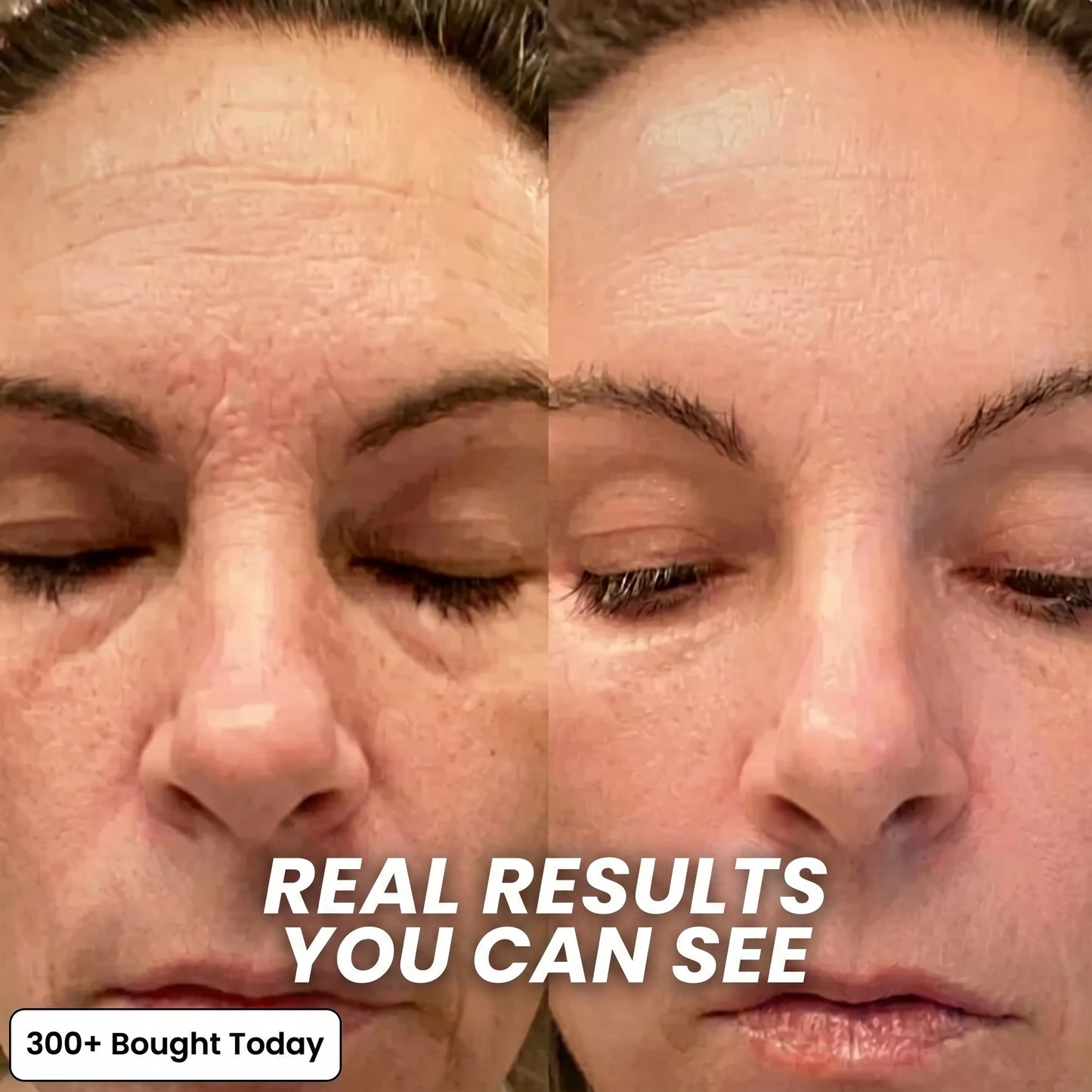 Bio-Collagen PDRN Plumping Stick