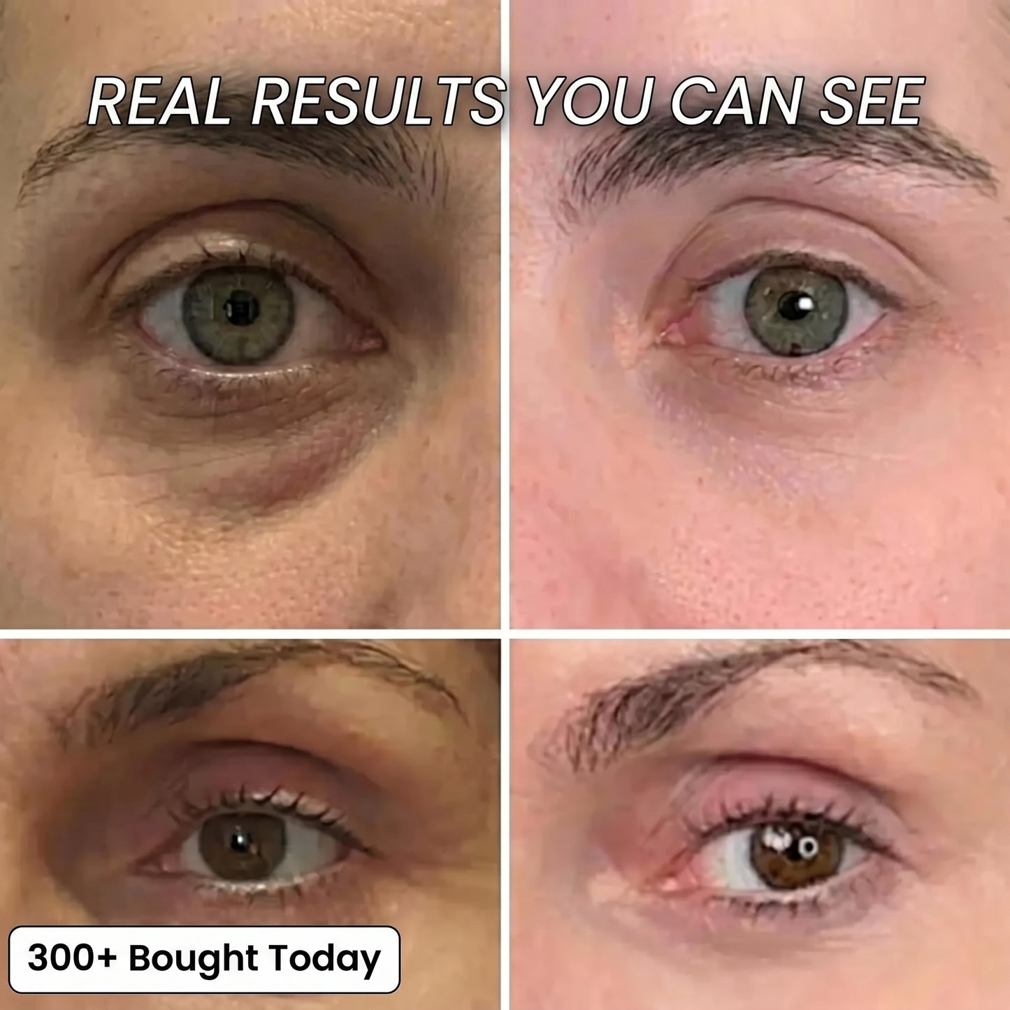 Bio-Collagen PDRN Plumping Stick